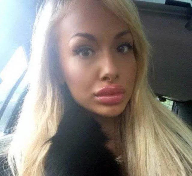 Les filles en plastique - #10 