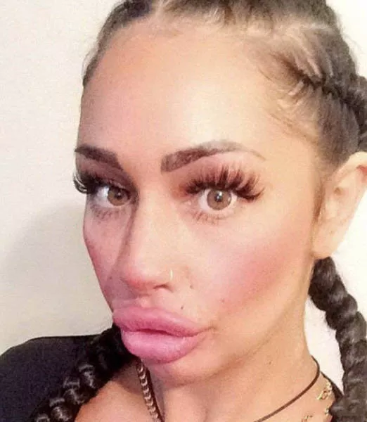Les filles en plastique - #15 