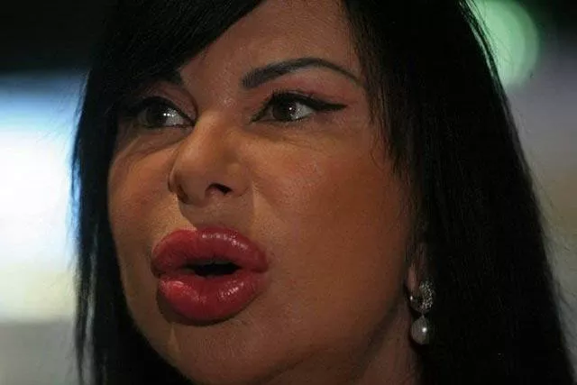 Les filles en plastique - #20 