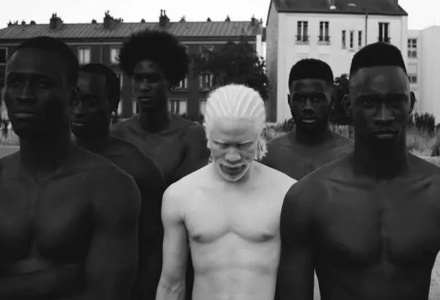 Decouvrez ce genre dhumain rare et incroyable - #3 