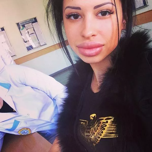Anya shows off her monster lips - #10 