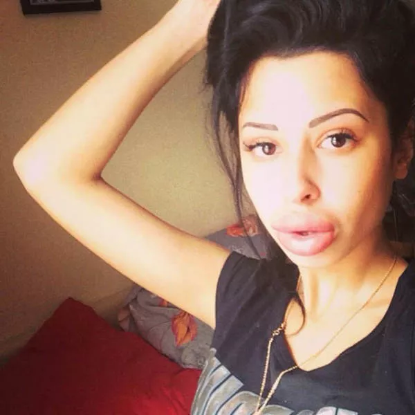 Anya shows off her monster lips - #14 