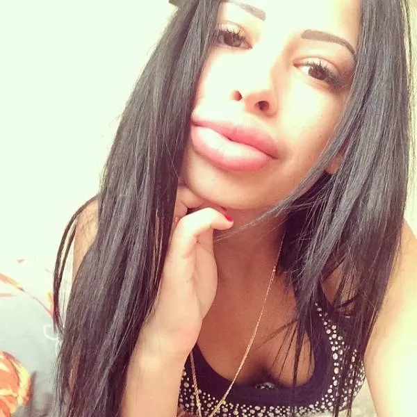 Anya shows off her monster lips
