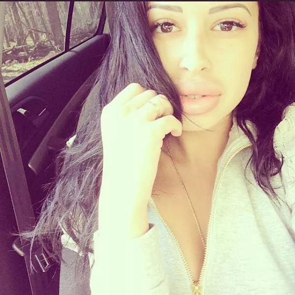 Anya shows off her monster lips - #18 