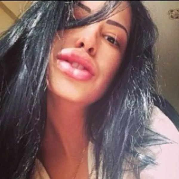 Anya shows off her monster lips - #19 