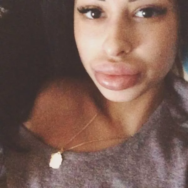 Anya shows off her monster lips - #3 