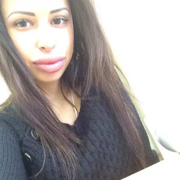Anya shows off her monster lips - #7 