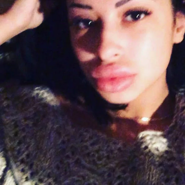 Anya shows off her monster lips - #8 
