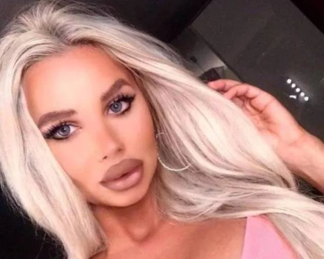 To swell the lips is a good idea - #16 