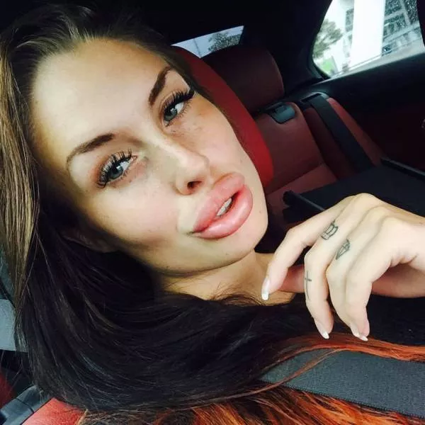 To swell the lips is a good idea