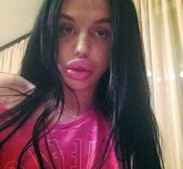 To swell the lips is a good idea - #4 