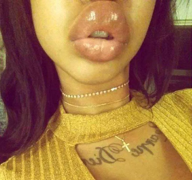 To swell the lips is a good idea - #8 