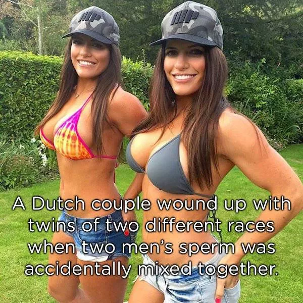 Amazing facts about twins