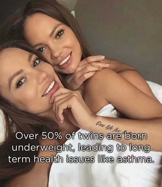 Amazing facts about twins - #4 
