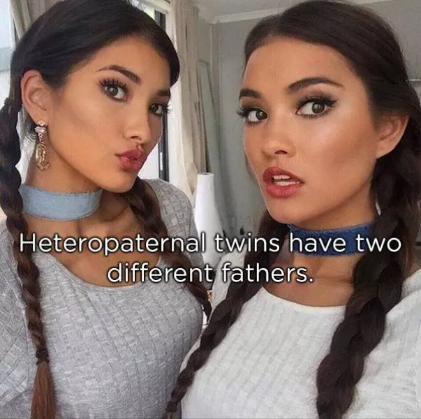 Amazing facts about twins - #6 