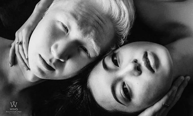 Albinism around the world in pictures - #13 