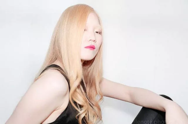 Albinism around the world in pictures - #4 