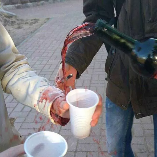 The most disgusting photos - #12 