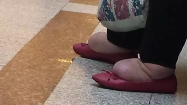 The very disgusting images found on the internet - #10 