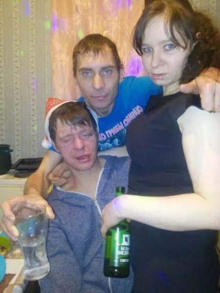 Les images les tres degoutante trouver sur internet - #16 