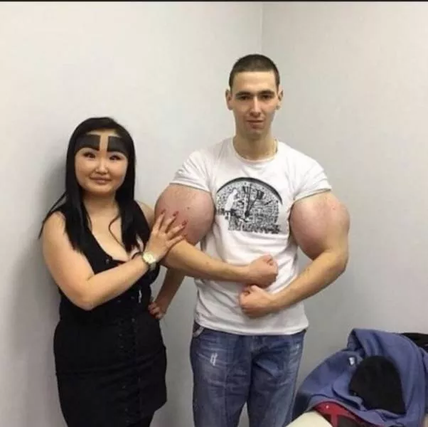 Les images les tres degoutante trouver sur internet - #6 
