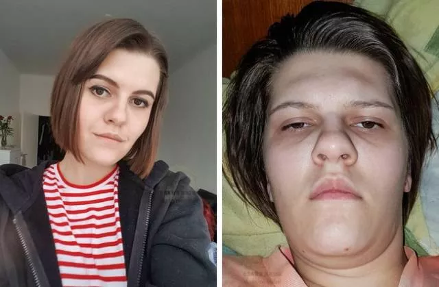 Instagram vs reality the difference is striking - #2 