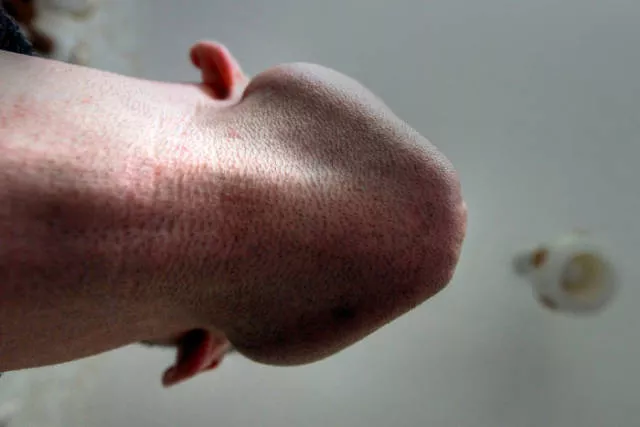 The humor of bearded chins