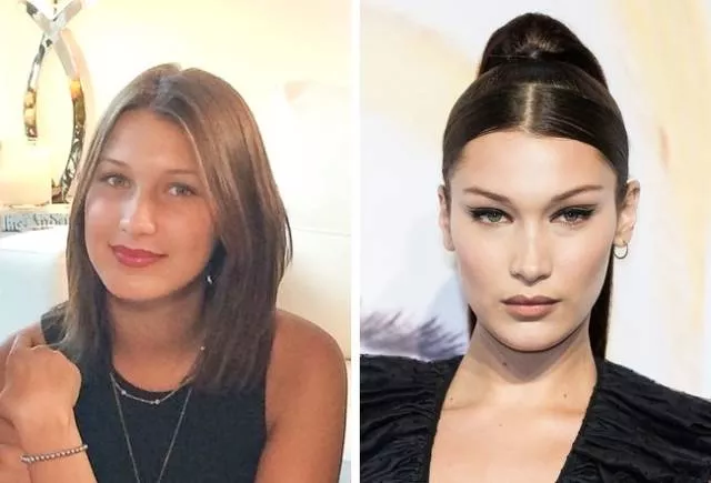 Models before and after they get famous - #5 