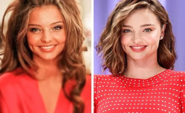 Models before and after they get famous - #7 