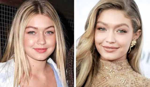 Models before and after they get famous - #9 