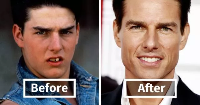 Before after visual transformation - #36 