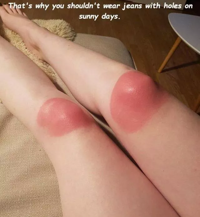 When the fail hurts but makes you laugh - #36 