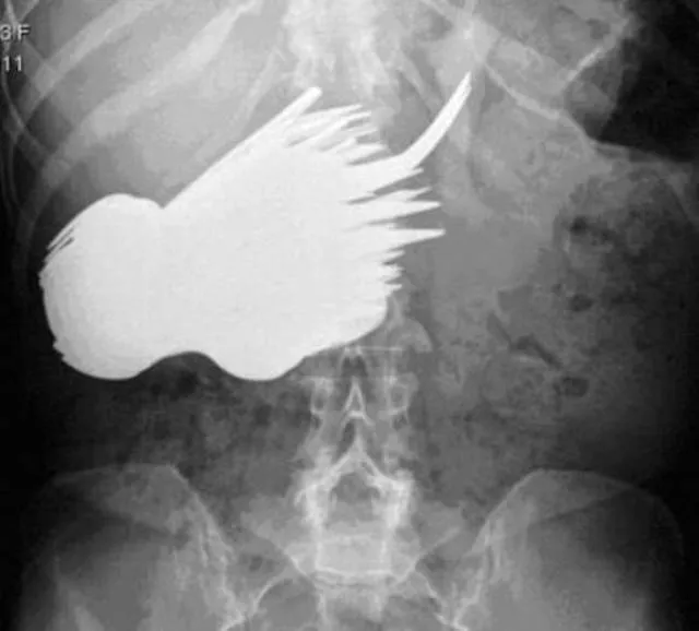 Le 3 x rays les plus terribles au monde - #1 