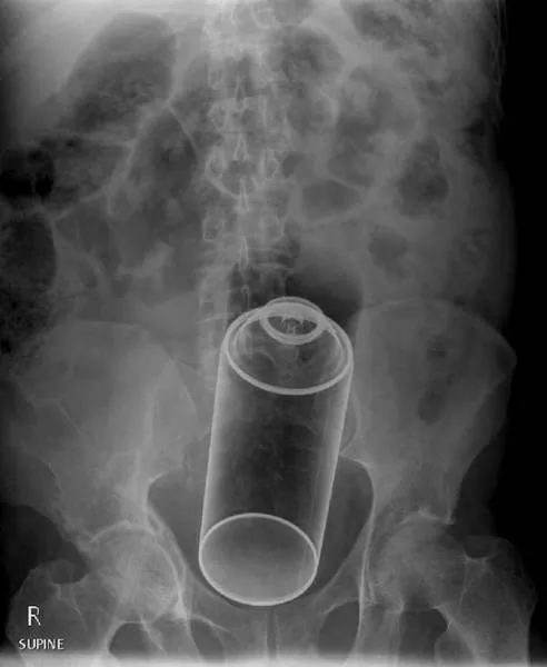 Le 3 x rays les plus terribles au monde - #2 
