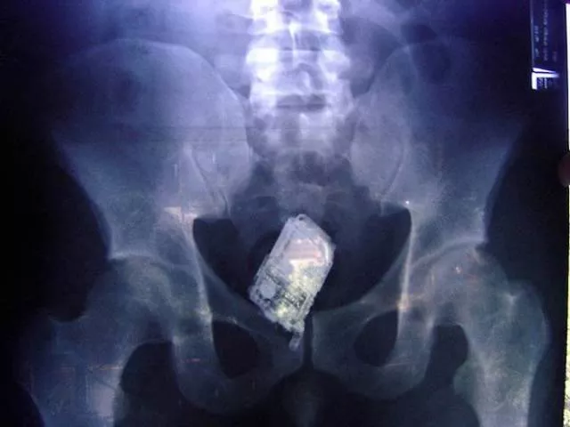 Le 3 x rays les plus terribles au monde - #4 