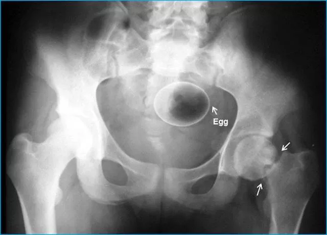 Le 3 x rays les plus terribles au monde