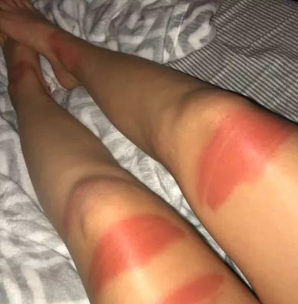 Ripped jeans fails in pictures - #10 