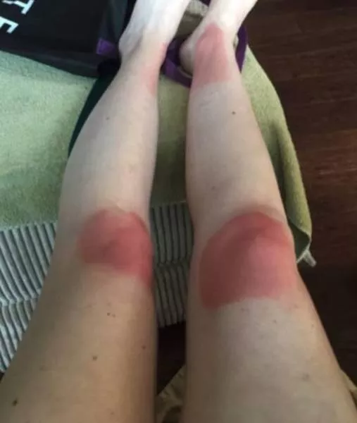 Ripped jeans fails in pictures - #11 