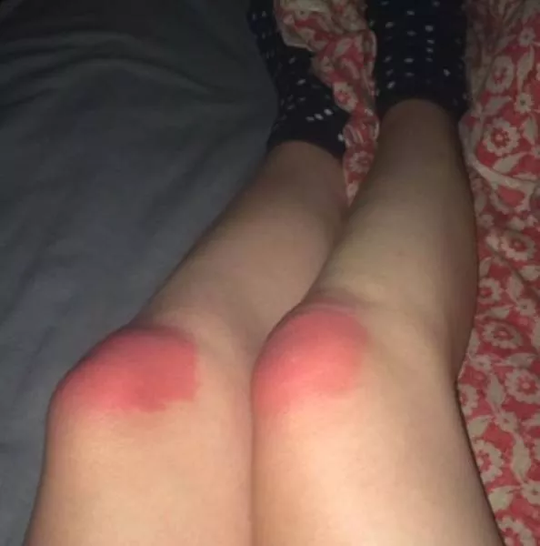 Ripped jeans fails in pictures - #13 