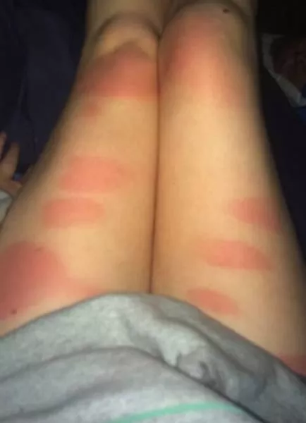 Ripped jeans fails in pictures - #15 