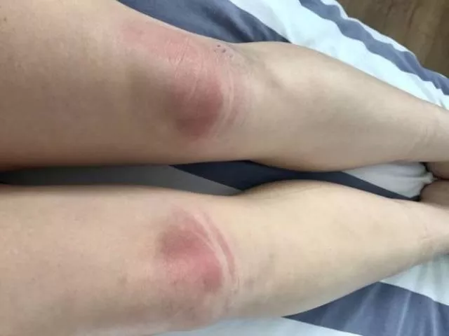 Ripped jeans fails in pictures - #16 