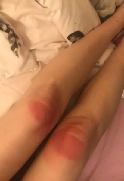 Ripped jeans fails in pictures - #17 