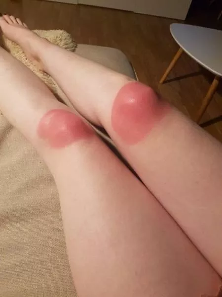 Ripped jeans fails in pictures - #2 