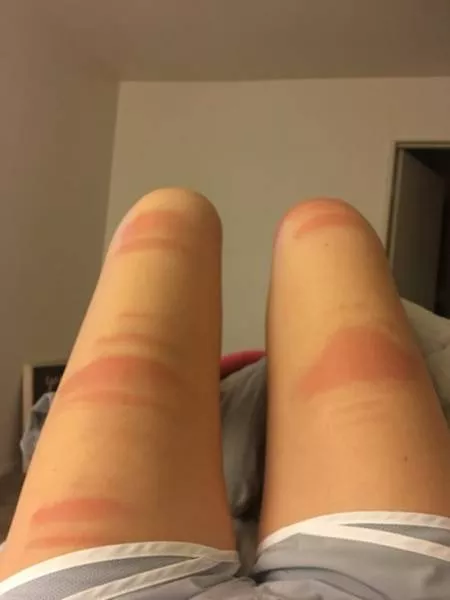 Ripped jeans fails in pictures - #4 