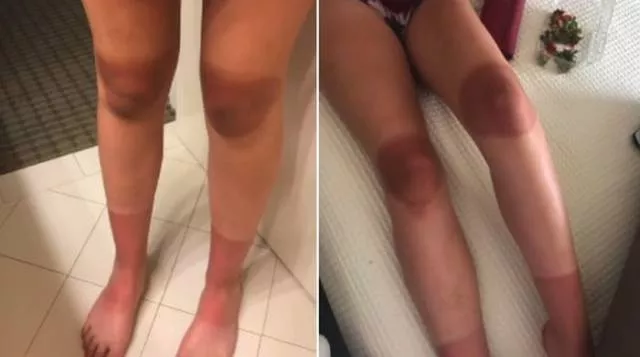 Ripped jeans fails in pictures - #5 
