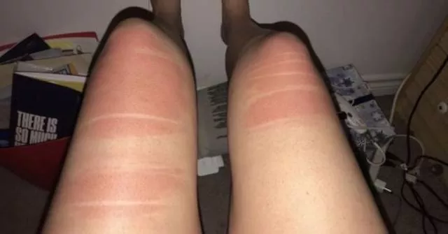 Ripped jeans fails in pictures - #6 