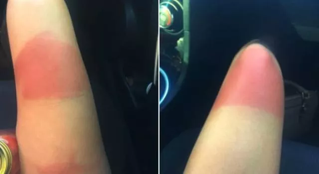Ripped jeans fails in pictures - #7 