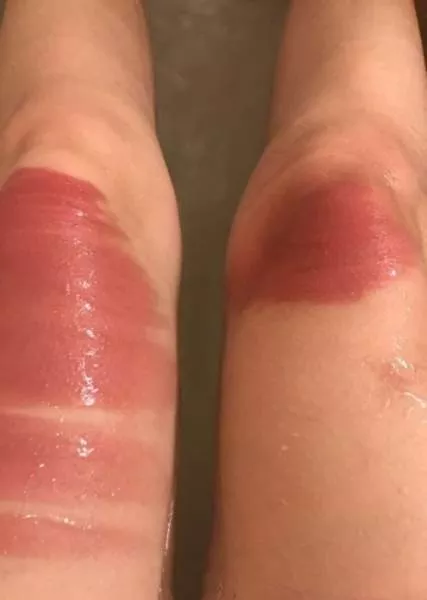 Ripped jeans fails in pictures - #9 