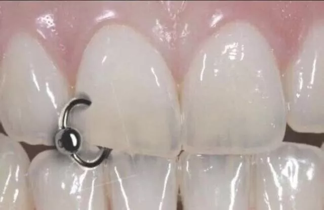 The most disgusting images of the world - #26 
