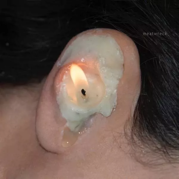 The most disgusting images of the world - #28 